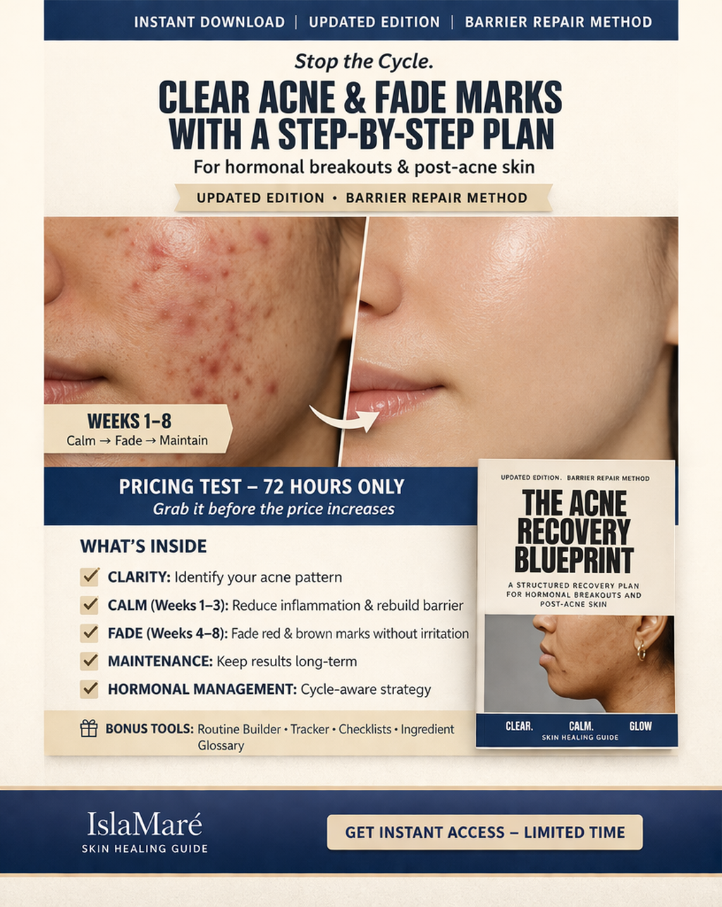 Acne Recovery Blueprint